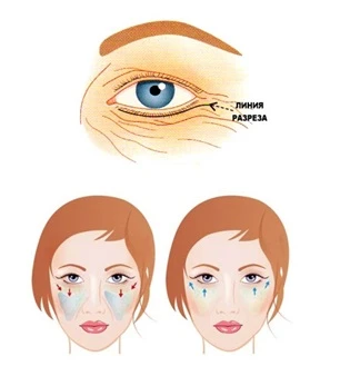 Омоложение лица Омоложение лица