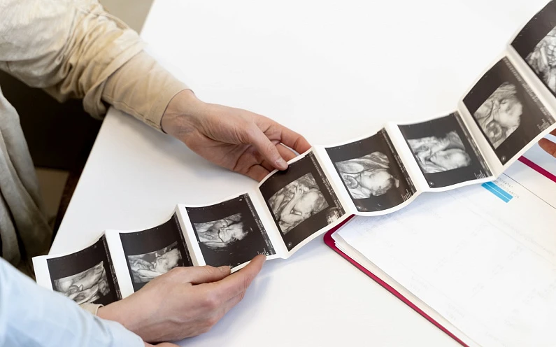 Ультразвуковое исследование во время беременности: 256 оттенков серого и не только…